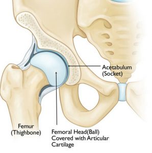 hip joint pain, hip surgeon in Kenya, hip treatment in Nairobi, Kenya, Nairobi Spine Orthopaedic Surgeon in Kenya