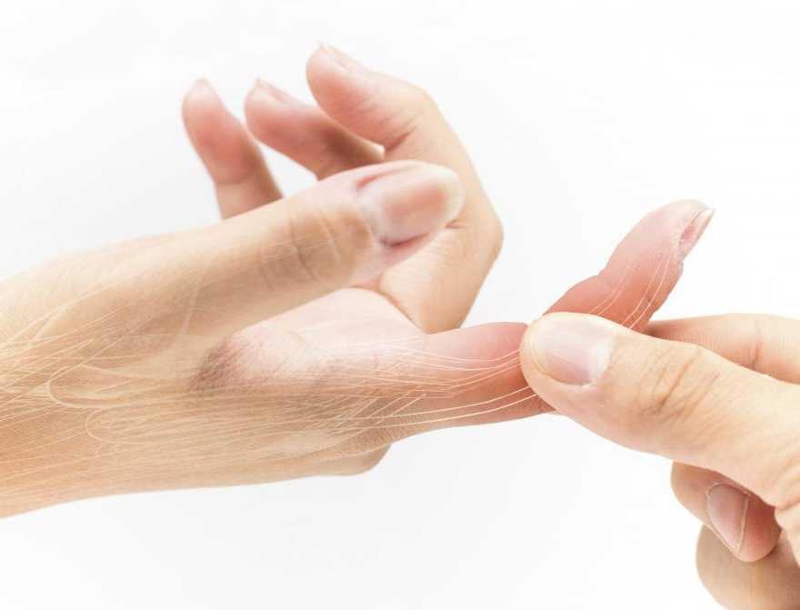 Finger fractures , broken fingers, finger fracture treatment, causes of finger fractures