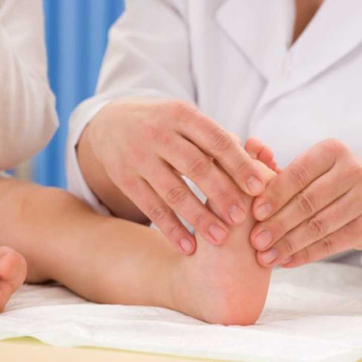 clubfoot, treatment in kenya, foot and ankle sugeons in kenya,