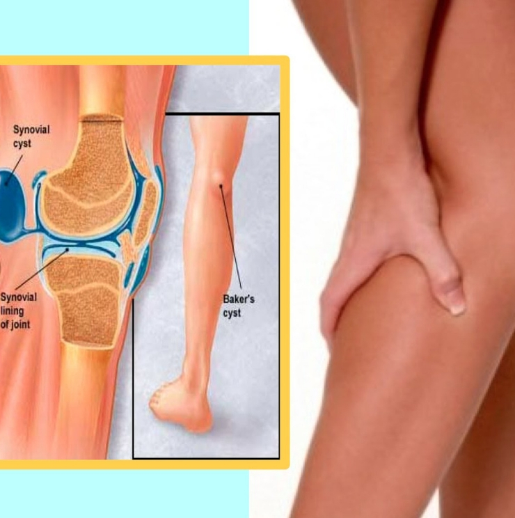 Knee pain, Knee pain causes, knee pain symptoms, knee pain treatment, Unstable kneecap, unstable kneecap treatment, Kneecap surgery, loose kneecap exercices, Patella intability