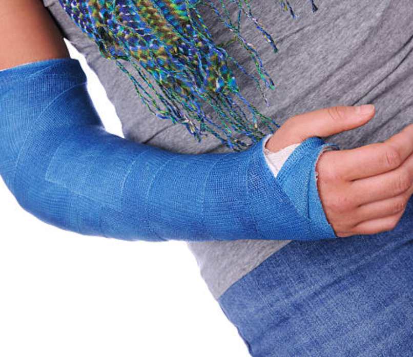 Cast and splints, cast and splints care, cast and splints care types,