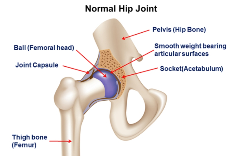 Total hip replacement, Total hip replacement