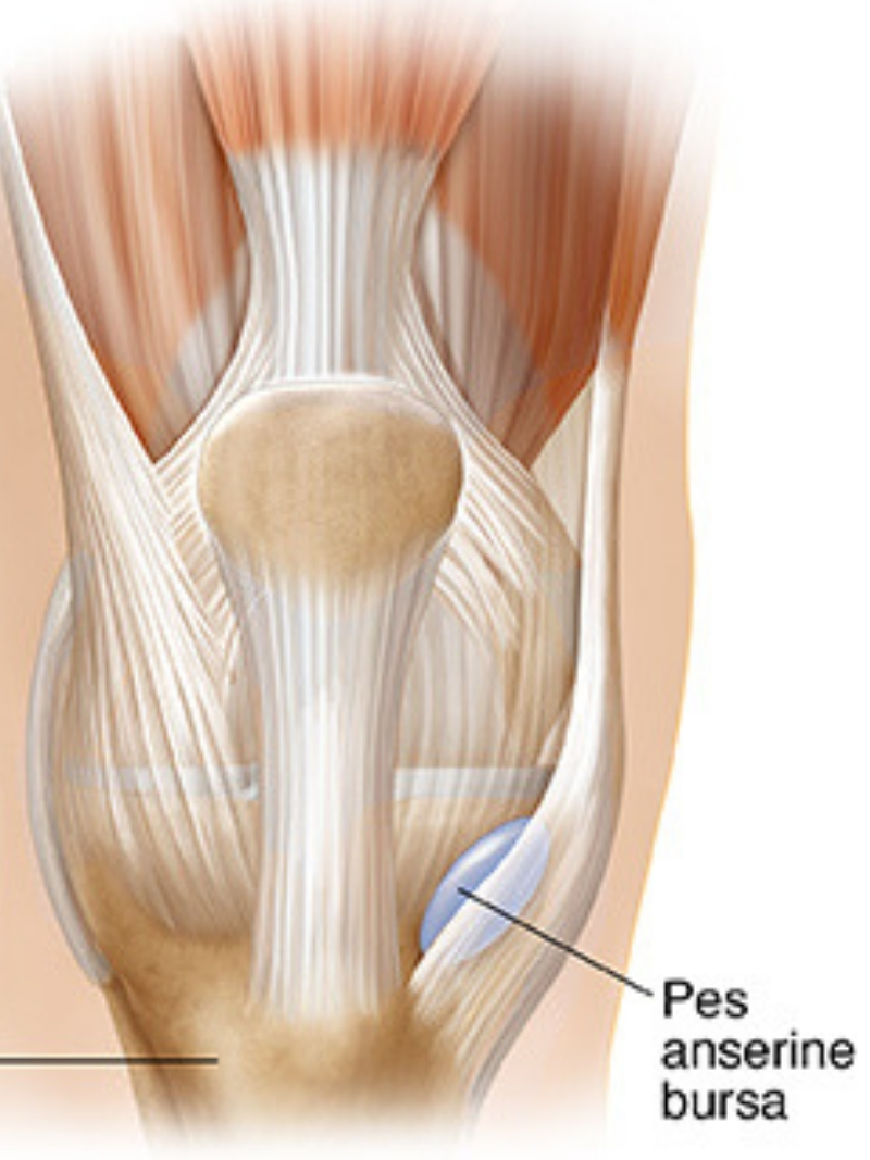 knee bursitis,pesanserine, Knee tendon bursits, Knee surgeon, knee specialist, Knee, Knee pain, knee doctors