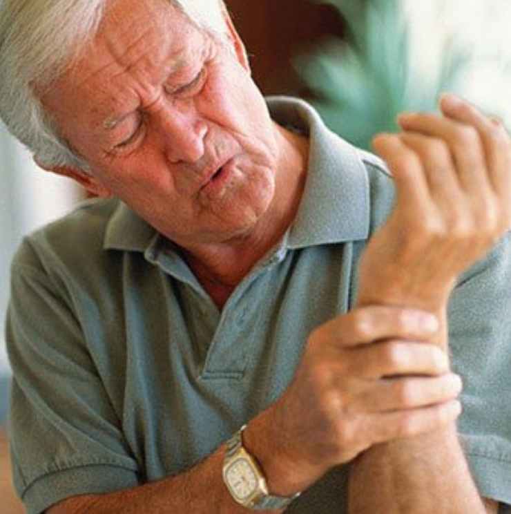 Wrist arthritis, arthritis treatment in Kenya, Wrist surgeons, Causes of arthritis, wrist doctors