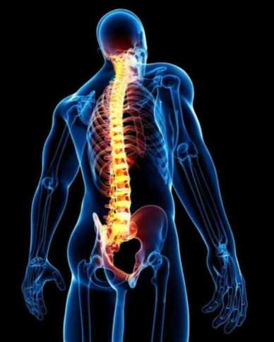 Spinal stenosis, treatment of spinal stenosis in Kenya, Causesof spinal stenosis, spine surgery in Kenya, Physical therapy in Nairobi,