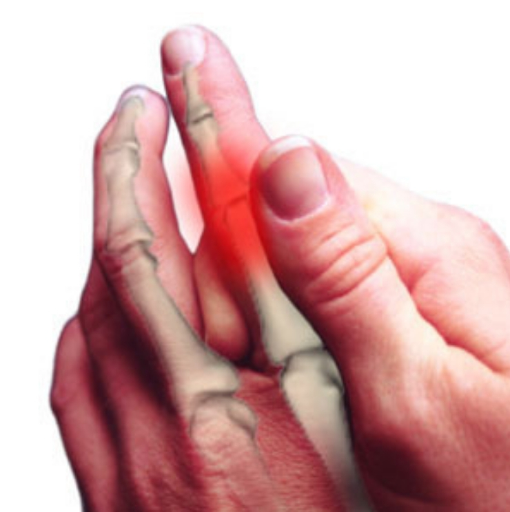 Trigger finger, Trigger finger care and treatment, Trigger finger causes and symptoms,