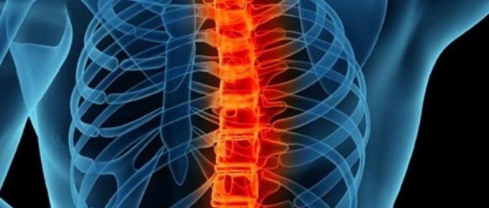 spinal deformity, revision spine surgery in Kenya